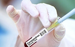 Od wtorku nie ma nowych zakażeń na Warmii i Mazurach. Do tej pory w Polsce odnotowano 23 571 przypadków koronawirusa
